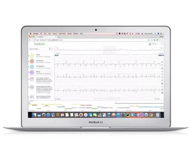 <h2>The Product</h2> <p>is an off-the-shelf software for remote patient monitoring and clinical diagnostics to enable constant cardiac monitoring and patient health surveillance. The tool works with digital health devices and apps to interpret and annotate electrocardiograms.</p> 